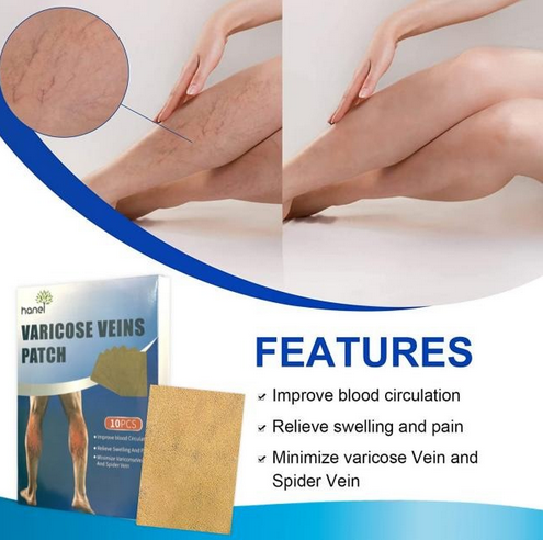 PARCHES PARA VARICES